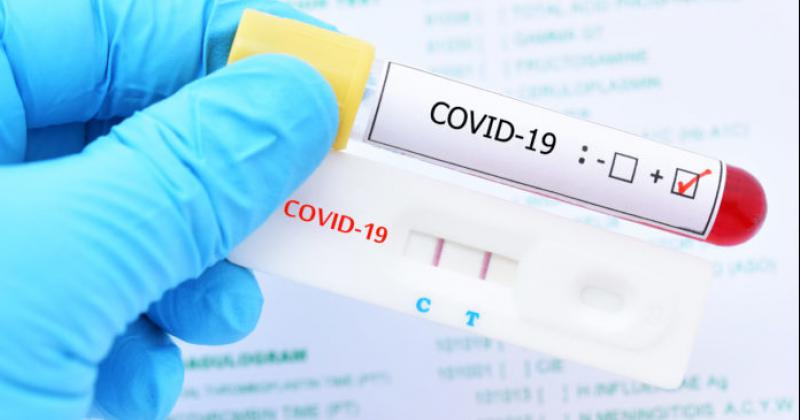 Los test de Covid clave para luchar contra la pandemia 