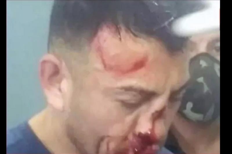 El acusado llegó con el tabique roto tras la brutal paliza con la que lo recibieron en la comisaría