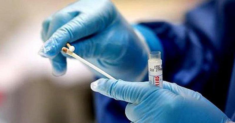 128 nuevos casos de Covid-19 y 9 fallecimientos