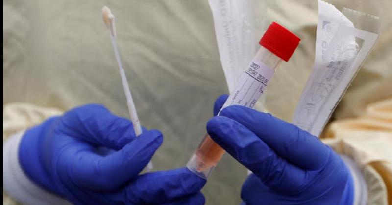 Dos mujeres perdieron la vida por coronavirus y el número de muertes en la ciudad alcanzó las 385 personas