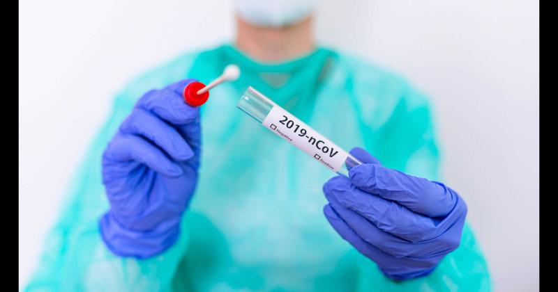 Por Test de Antígenos hubo un positivo y un resultado negativo 