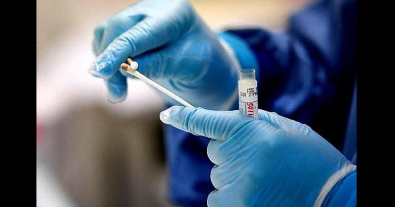 De las 25 muestras analizadas en el Instituto Maiztegui tres dieron positivo