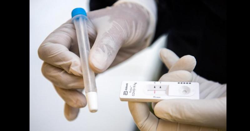 El test r�pido es orientativo Si es positivo se considera como tal y si es negativo el paciente deben hacerse un PCR