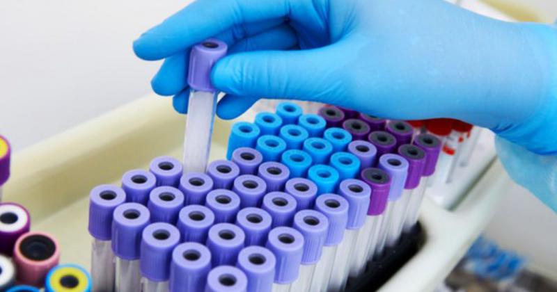 En distintos momentos de la pandemia se enviaron al Malbr�n muestras para secuenciar