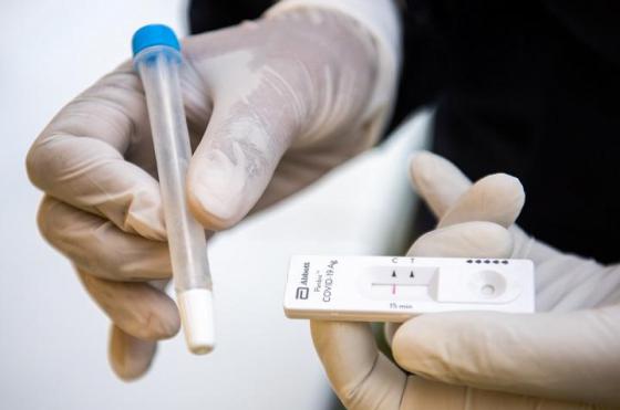 El test r�pido es orientativo Si es positivo se considera como tal y si es negativo el paciente deben hacerse un PCR
