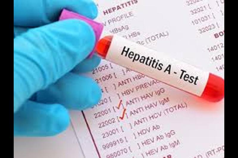 Hepatitis A- la confirmacioacuten de 34 nuevos casos pone a Argentina en zona de alerta